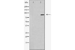 Western blot analysis of extracts from LOVO cells, using RHG9 antibody. (ARHGAP9 抗体  (Internal Region))