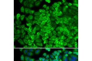 Immunofluorescence analysis of HeLa cells using GLA Polyclonal Antibody (GLA 抗体)