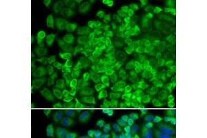 Immunofluorescence analysis of HeLa cells using GLA Polyclonal Antibody (GLA 抗体)