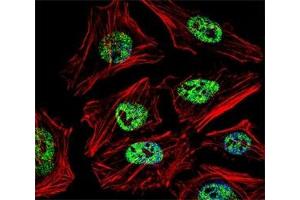 Immunofluorescence (IF) image for anti-Nanog Homeobox (NANOG) (AA 15-49) antibody (ABIN3031942)