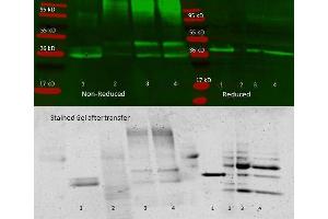 Anti aldolase antibody – immunoprecipitation and western blot. (ALDOA 抗体)