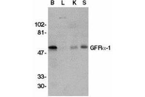 Western Blotting (WB) image for anti-GDNF Family Receptor alpha 1 (GFRA1) antibody (ABIN2473776) (GFRA1 抗体)