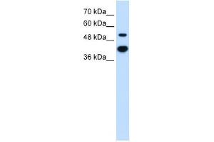 MMP1 antibody used at 2. (MMP1 抗体)