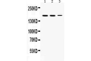 Western blot analysis of KDM5B expression in rat testis extract ( Lane 1), mouse testis extract ( Lane 2) and HEPG2 whole cell lysates ( Lane 3).