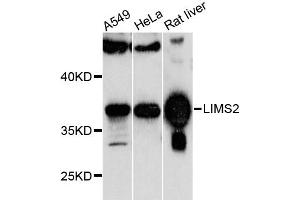Western blot analysis of extracts of various cell lines, using LIMS2 antibody (ABIN6293255) at 1:1000 dilution. (LIMS2 抗体)