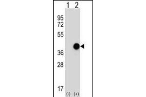 Western blot analysis of CTSK (arrow) using rabbit polyclonal CTSK Antibody (Center ) (ABIN656812 and ABIN2846026). (Cathepsin K 抗体  (AA 97-126))