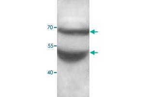 Western blot analysis of human fetal brain lysate with ADAMTS5 polyclonal antibody  at 1 : 500 dilution. (ADAMTS5 抗体  (C-Term))