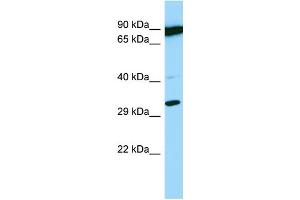 Host: Rabbit Target Name: PSMB11 Sample Type: OVCAR-3 Whole Cell lysates Antibody Dilution: 1. (PSMB11 抗体  (C-Term))