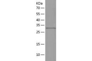 IMPACT Protein (AA 1-320) (His tag)