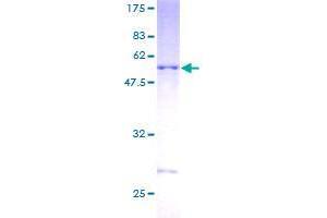 DNAJC27 Protein (AA 1-273) (GST tag)
