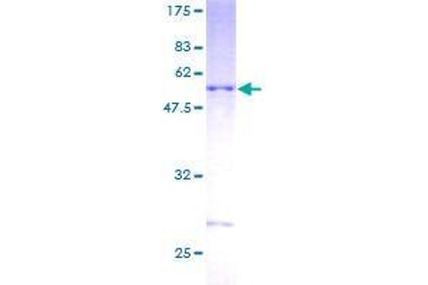 DNAJC27 Protein (AA 1-273) (GST tag)
