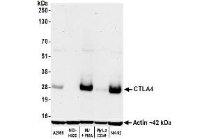 Western Blotting (WB) image for anti-Cytotoxic T-Lymphocyte-Associated Protein 4 (CTLA4) (C-Term) antibody (ABIN7795649)