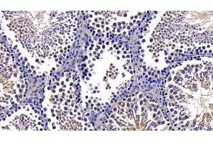 Immunohistochemistry (IHC) image for anti-DEAD (Asp-Glu-Ala-Asp) Box Polypeptide 58 (DDX58) (AA 1-211) antibody (ABIN7440305)