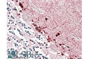 ABIN571185 (3. (ALDH9A1 抗体  (Internal Region))
