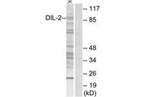 Western blot analysis of extracts from Jurkat cells, using DIL-2 Antibody. (TPX2 抗体  (AA 301-350))