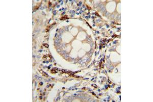Immunohistochemistry (IHC) image for anti-Amine Oxidase, Copper Containing 3 (Vascular Adhesion Protein 1) (AOC3) antibody (ABIN3003794) (AOC3 抗体)