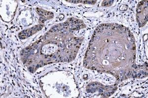 IHC analysis of p57 Kip2/CDKN1C using anti-p57 Kip2/CDKN1C antibody (ABIN7603232). (CDKN1C 抗体  (N-Term))