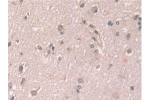 Detection of GCA in Human Cerebrum Tissue using Polyclonal Antibody to Grancalcin (GCA) (Grancalcin 抗体  (AA 1-139))