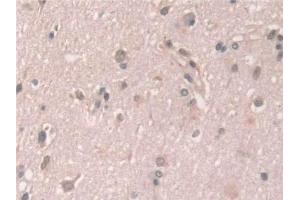 Detection of GCA in Human Cerebrum Tissue using Polyclonal Antibody to Grancalcin (GCA) (Grancalcin 抗体  (AA 1-139))