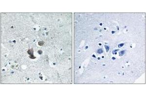 Immunohistochemistry analysis of paraffin-embedded human brain tissue, using IBP7 Antibody. (IGFBP7 抗体  (AA 191-240))