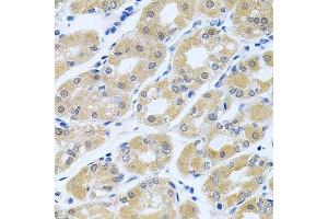 Immunohistochemistry of paraffin-embedded human stomach using GNE antibody. (GNE 抗体  (AA 1-150))
