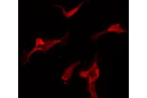 Immunofluorescence (fixed cells) (IF/ICC) image for anti-Calcium/calmodulin-Dependent Protein Kinase II beta (CAMK2B) (pThr286) antibody (ABIN6256533)