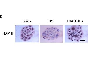 Immunocytochemistry (ICC) image for anti-BMP and Activin Membrane-Bound Inhibitor Homolog (BAMBI) (AA 101-200) antibody (ABIN1714490)