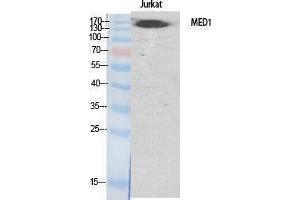 Western Blotting (WB) image for anti-Mediator Complex Subunit 1 (MED1) (Internal Region) antibody (ABIN3187327) (MED1 抗体  (Internal Region))