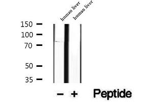 Western blot analysis of extracts of human liver tissue, using P3H3 antibody. (LEPREL2 抗体  (Internal Region))