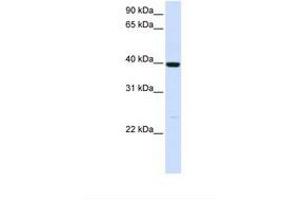 Image no. 1 for anti-Alcohol Dehydrogenase 1A (Class I), alpha Polypeptide (ADH1A) (AA 110-159) antibody (ABIN6738000) (ADH1A 抗体  (AA 110-159))