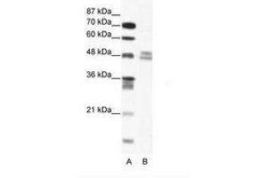 Image no. 1 for anti-Thyroid Hormone Receptor Interactor 13 (TRIP13) (AA 83-132) antibody (ABIN202513) (TRIP13 抗体  (AA 83-132))