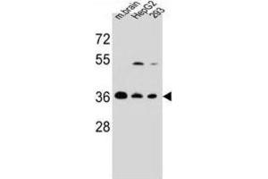 Western Blotting (WB) image for anti-F-Box Protein 2 (FBXO2) antibody (ABIN2995568) (FBXO2 抗体)