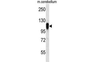 Western Blotting (WB) image for anti-F-Box Protein 41 (FBXO41) antibody (ABIN2996836) (FBXO41 抗体)