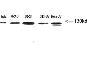 Western Blot (WB) analysis of HeLe,MCF7,U2OS,3T3-UV,HeLa-UV using Integrin β3 Polyclonal Antibody diluted at 1:2000 (Integrin beta 3 抗体  (Internal Region))