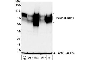 Western Blotting (WB) image for anti-Nectin-1 (NECTIN1) (AA 225-275) antibody (ABIN7795684) (Recombinant Nectin-1 (NECTIN1) (AA 225-275) 抗体)