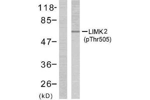 Western blot analysis of extract from NIH/3T3 cells treated or untreated with UV (60min), using LIMK2 (phospho- Thr505) antibody (E011127). (LIMK2 抗体  (pThr505))