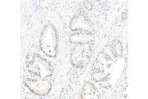 anti-Protein Phosphatase 4, Catalytic Subunit (PPP4C) (AA 1-50) antibody