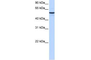 WB Suggested Anti-DPH2 Antibody Titration: 0.