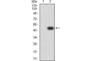 Western blot analysis using TTF1 mAb against HEK293 (1) and TTF1 (AA: 1-150)-hIgGFc transfected HEK293 (2) cell lysate. (TTF1 抗体  (AA 1-150))