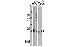 Western blot analysis of anti-Park7 (DJ-1) Antibody (N-term) in mouse brain,kidney,liver tissue lysates and NIH-3T3, Hela cell line lysates (35ug/lane). (PARK7/DJ1 抗体  (N-Term))