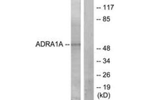 Western Blotting (WB) image for anti-Adrenoceptor alpha 1A (ADRA1A) (AA 341-390) antibody (ABIN2889851) (alpha 1 Adrenergic Receptor 抗体  (AA 341-390))