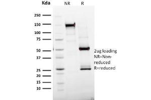 SDS-PAGE Analysis Purified Ki67 Mouse Monoclonal Antibody (MKI67/2465). (Ki-67 抗体  (AA 2293-2478))