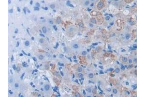 IHC-P analysis of Mouse Ovary Tissue, with DAB staining. (BDNF 抗体  (AA 139-249))