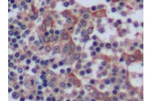 Detection of CK8 in Human Tonsil Tissue using Polyclonal Antibody to Cytokeratin 8 (CK8) (KRT8 抗体  (AA 92-393))
