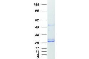 Validation with Western Blot