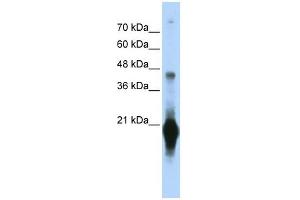 C17ORF49 antibody used at 1 ug/ml to detect target protein. (C17orf49 抗体  (Middle Region))