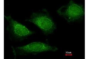 Immunofluorescence analysis of methanol-fixed HeLa, using DNA polymerase gamma antibody at 1:200 dilution. (POLG 抗体  (AA 829-1201))