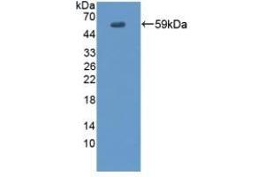 Detection of Recombinant EVPL, Human using Polyclonal Antibody to Envoplakin (EVPL) (Envoplakin 抗体  (AA 3-258))