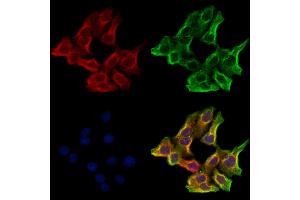 ABIN6265743 and ABIN6273181 staining Hela cells by IF/ICC.