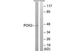 Western blot analysis of extracts from HepG2 cells, using PDK2 Antibody. (PDK2 抗体  (AA 260-309))